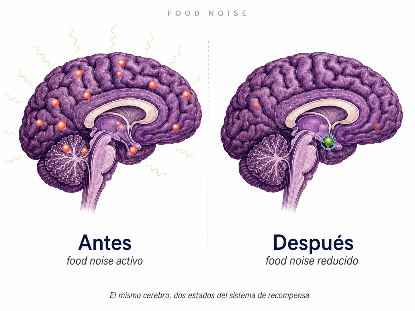 Cerebro en dos estados: con burbujas de pensamiento sobre alimentos a la izquierda, y la corteza en calma a la derecha.